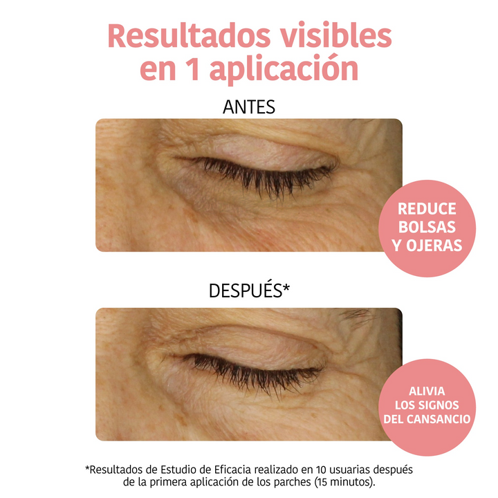 Parches para Ojos Antifatiga con Vitamina C